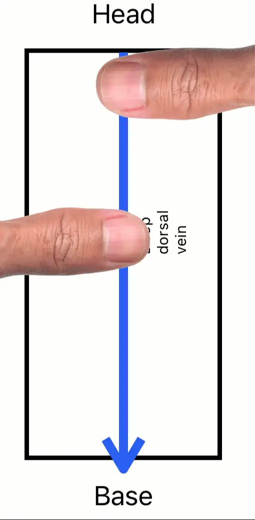 Why Our Wheel Beats Manual Exercises (And Why That Matters)